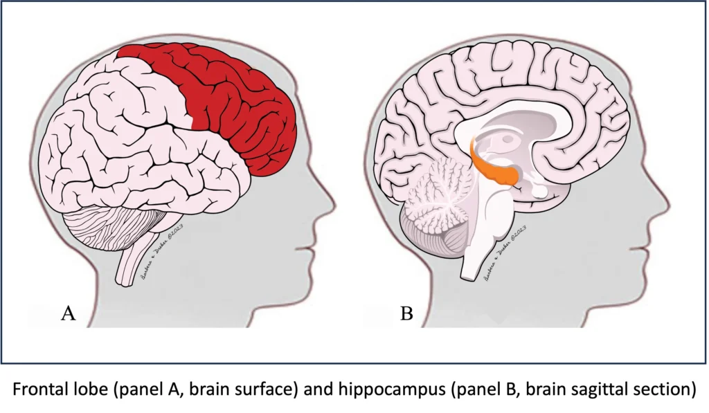 brain-surface-frontal-lobe